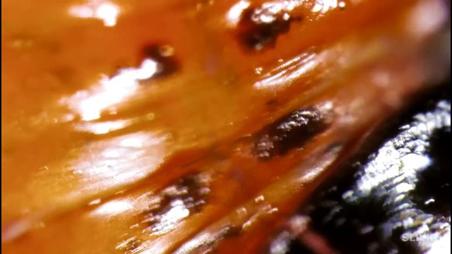 Клетки крови в глазу человека! – [под микроскопом