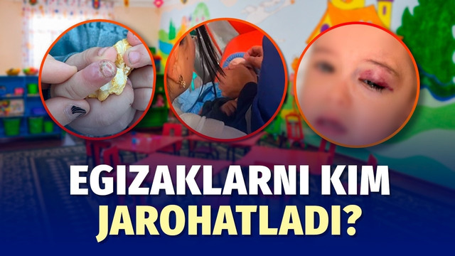 Davlat bog‘chasida dahshat: biri komaga tushdi, biri kaltaklandi