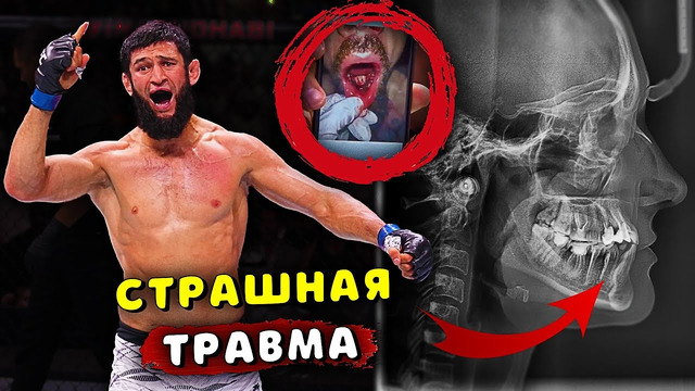 ПОСЛЕ БОЯ ХАМЗАТ ЧИМАЕВ – РОБЕРТ УИТТАКЕР СЛУЧИЛОСЬ СТРАШНОЕ/НОВОЕ ПОКОЛЕНИЕ БОЙЦОВ/Звуки ММА