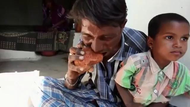 30-летний индиец ест кирпичи и грязь