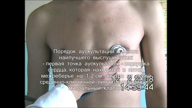 Аускультация сердца