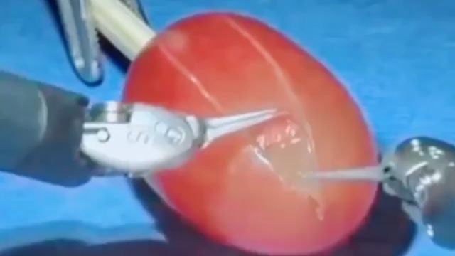 They Did Surgery On a Grape — PewDiePie