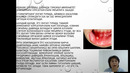 Стоматитлар – Якубова Ф.Х