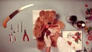 Teddy Has An Operation