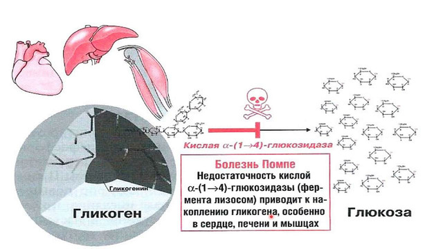 Гликогенные болезни