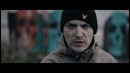 Луперкаль – лузервиль