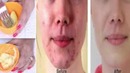 Юзни тиник, гузал килишнинг табиий усули