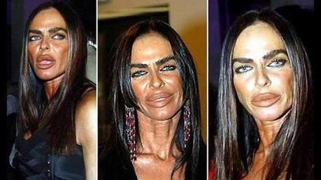 10 жертв "Пластической Хирургии&quot