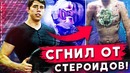 Качок СГНИЛ от стероидов / Настоящая жесть! необратимые последствия