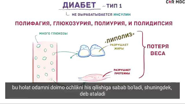 Кандли диабет турларининг қиёсий ташҳиси