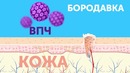 10 Способов раз и Навсегда Избавиться от Бородавок и Папиллом