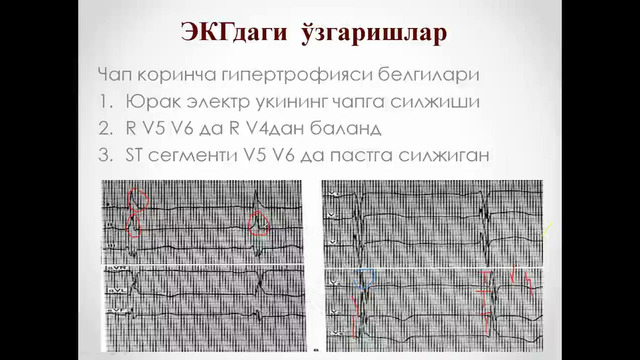 Хафакон касаллиги – Расулев Ё.Э