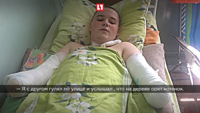 16 летний подросток из Барнаула рассказал, как лишился рук, спасая котенка