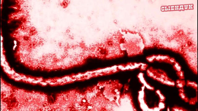 Сыендук-Вирус Эбола в России