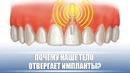 Почему наше тело отвергает импланты? / DeeaFilm