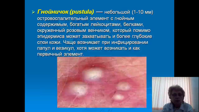 5 и 6 курсы. Детская инфекция. Экзантемы у детей