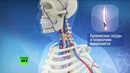 В Китае провели уникальную операцию по пересадке головы обезьяне