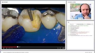 Вебинар: Основы препарирования зубов под керамические вкладки и накладки