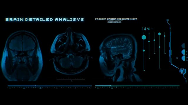 Dooplett – Во мне живут два разных человека