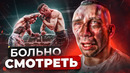 ТОП 5 СТРАШНЫХ ТРАВМ В ПОП ММА