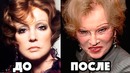 ЗНАМЕНИТЫЕ СОВЕТСКИЕ АКТРИСЫ которые делали пластические операции