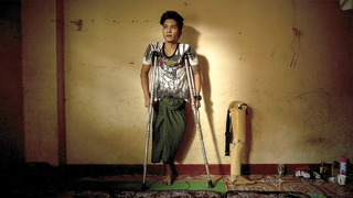 Без ноги или в изгнании: как военный переворот изменил жизнь мьянманцев