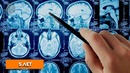 Что будет если бросить курить