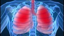 10 ужасных инородных тел, найденных в человеке