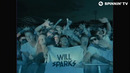 Will Sparks – Are You Crazy (Official Music Video)