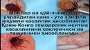 Навоий вилоят ДСЭНМ огохлантиради