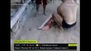 В Бразилии акула напала на туристку на пляже продолжение
