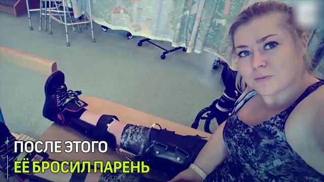 Девушка решила стать моделью после страшной аварии