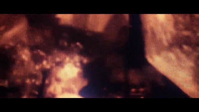 Of Virtue – Surrounded (Official Video 2018)