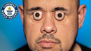Shocking World Record Eyeball Pop – Guinness World Records