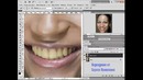 Отбеливание зубов в программе Photoshop