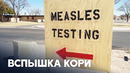 Первую за 10 лет смерть от кори зарегистрировали в США
