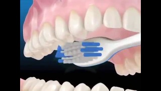 Профессиональная чистка зубов. Как правильно чистить зубы зубной щеткой