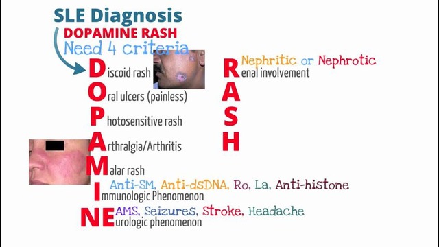Systemic Lupus Erythematosus (SLE) / Системная красная волчанка (СКВ)