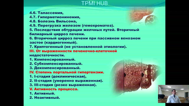 3 – 6 курсы, Факультетские внутренние болезни. Цирроз печени – Турсунбаев А.К