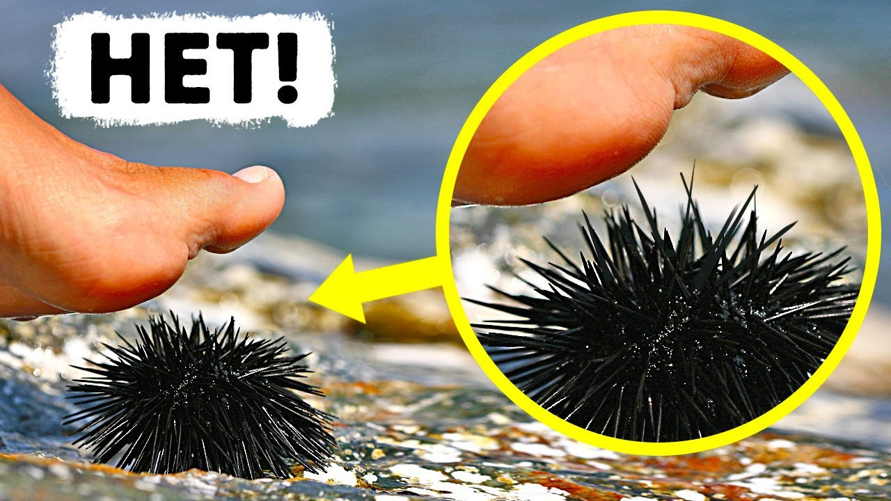 наступил на морского ежа что делать