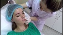 Elena864 – Увеличение губ и Биоревитализация | МОЙ ОПЫТ