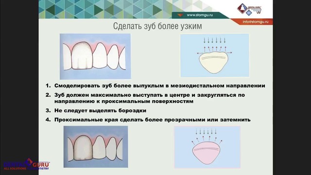 Вебинар: Клинические случаи исправления прикуса с помощью композитной реставрации
