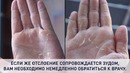 10 Сигналов Нашего Тела, К Которым Нужно Отнестись Серьезно