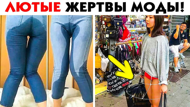 55 лютых жертв моды, которые не знают предела