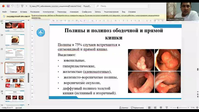 Unit 24. Тема 12. Заболеваний толстой кишки (НЯК, Болезнь Крона)