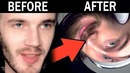 10 People Ruined By YouTube — PewDiePie