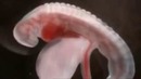 Medical Videos Why happens during Ovulation Ejaculation and Pregnancy