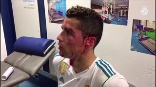Видео травмы Криштиану, снятое после матча
