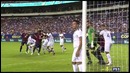 Игрок Сальвадора укусил Алтидора