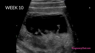 9 Months In The Womb / 9 месяцев в утробе